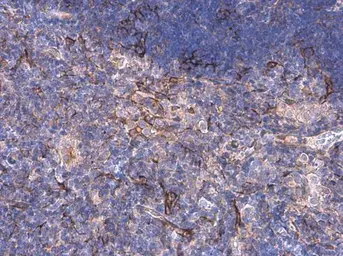 Anti-Desmuslin antibody used in IHC (Paraffin sections) (IHC-P). GTX134124