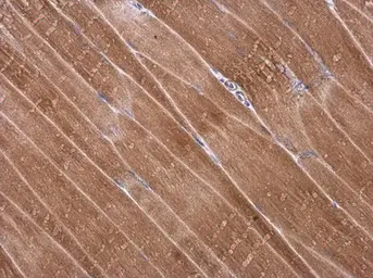 Anti-Desmuslin antibody used in IHC (Paraffin sections) (IHC-P). GTX134124