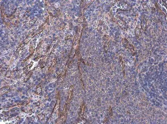 Anti-Desmuslin antibody used in IHC (Paraffin sections) (IHC-P). GTX134124