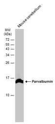 Anti-Parvalbumin antibody used in Western Blot (WB). GTX134127
