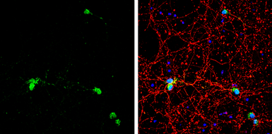 Anti-HuC antibody used in Immunocytochemistry/ Immunofluorescence (ICC/IF). GTX134128