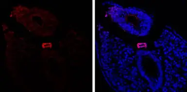 Anti-Brachyury antibody used in IHC (Paraffin sections) (IHC-P). GTX134133