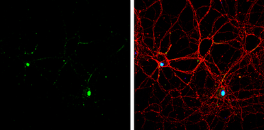 Anti-SATB2 antibody used in Immunocytochemistry/ Immunofluorescence (ICC/IF). GTX134135
