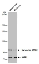 Anti-SATB2 antibody used in Western Blot (WB). GTX134135
