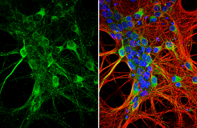 Anti-GluR1 antibody used in Immunocytochemistry/ Immunofluorescence (ICC/IF). GTX134137