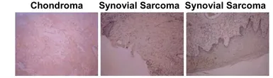 Anti-Osteocalcin antibody [OCG3] used in IHC (Paraffin sections) (IHC-P). GTX13419