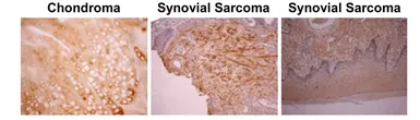 Anti-Osteocalcin antibody [OCG4] used in IHC (Paraffin sections) (IHC-P). GTX13421