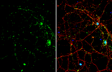 Anti-SMAD7 antibody used in Immunocytochemistry/ Immunofluorescence (ICC/IF). GTX134232