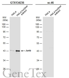 Anti-JunB antibody used in Western Blot (WB). GTX134236