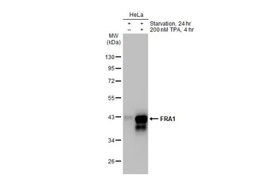 Anti-FRA1 antibody used in Western Blot (WB). GTX134242