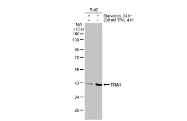 Anti-FRA1 antibody used in Western Blot (WB). GTX134242