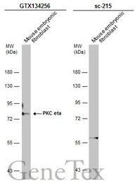 Anti-PKC eta antibody used in Western Blot (WB). GTX134256