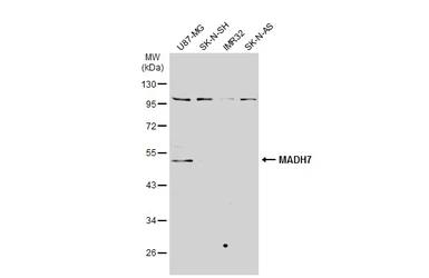 Anti-SMAD7 antibody used in Western Blot (WB). GTX134260