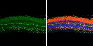 Anti-GNAT2 antibody used in IHC (Paraffin sections) (IHC-P). GTX134342