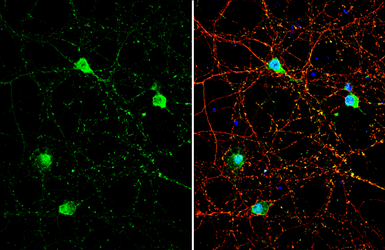 Anti-GNAT2 antibody used in Immunocytochemistry/ Immunofluorescence (ICC/IF). GTX134342