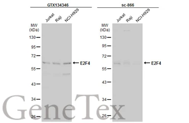 Anti-E2F4 antibody used in Western Blot (WB). GTX134346