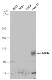 Anti-FGFR4 antibody used in Western Blot (WB). GTX134355