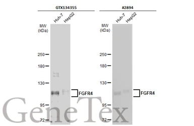 Anti-FGFR4 antibody used in Western Blot (WB). GTX134355