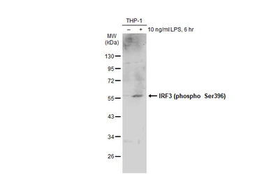 Anti-IRF3 (phospho Ser396) antibody used in Western Blot (WB). GTX134360
