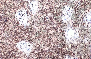 Anti-IRF3 (phospho Ser396) antibody used in IHC (Paraffin sections) (IHC-P). GTX134360