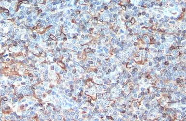 Anti-STING antibody used in IHC (Paraffin sections) (IHC-P). GTX134373