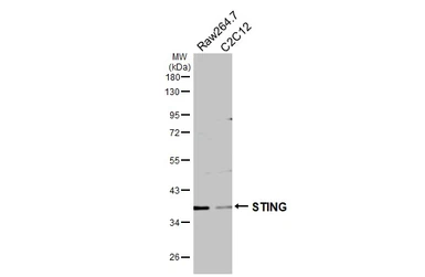 Anti-STING antibody used in Western Blot (WB). GTX134373