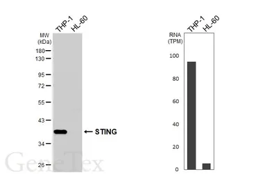 Anti-STING antibody used in Western Blot (WB). GTX134373