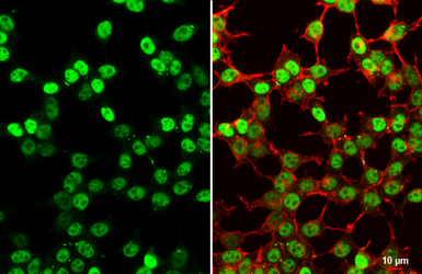Anti-SV40 T-antigen antibody used in Immunocytochemistry/ Immunofluorescence (ICC/IF). GTX134378
