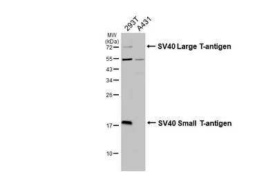 Anti-SV40 T-antigen antibody used in Western Blot (WB). GTX134378