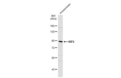 Anti-KIF6 antibody used in Western Blot (WB). GTX134401
