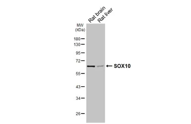 Anti-SOX10 antibody used in Western Blot (WB). GTX134405