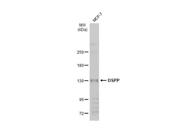 Anti-DSPP antibody used in Western Blot (WB). GTX134428