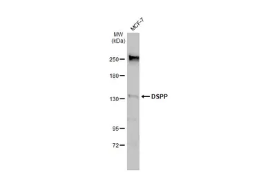 Anti-DSPP antibody used in Western Blot (WB). GTX134428