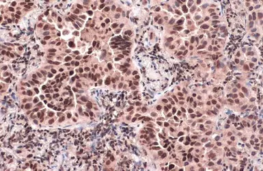 Anti-CENPA antibody used in IHC (Paraffin sections) (IHC-P). GTX134430