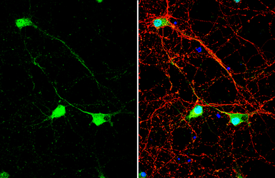 Anti-NHERF1 antibody used in Immunocytochemistry/ Immunofluorescence (ICC/IF). GTX134431