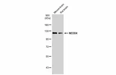 Anti-NEDD4 antibody used in Western Blot (WB). GTX134444