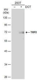 Anti-TRP2 antibody used in Western Blot (WB). GTX134445