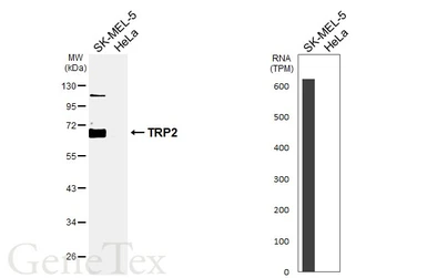 Anti-TRP2 antibody used in Western Blot (WB). GTX134445