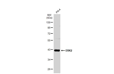 Anti-ERK2 antibody used in Western Blot (WB). GTX134457