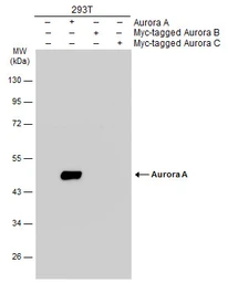Anti-Aurora A antibody used in Western Blot (WB). GTX134461