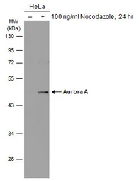Anti-Aurora A antibody used in Western Blot (WB). GTX134461