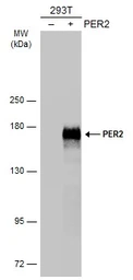 Anti-PER2 antibody used in Western Blot (WB). GTX134478