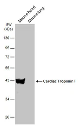 Anti-Cardiac Troponin T antibody used in Western Blot (WB). GTX134489