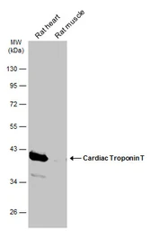 Anti-Cardiac Troponin T antibody used in Western Blot (WB). GTX134489