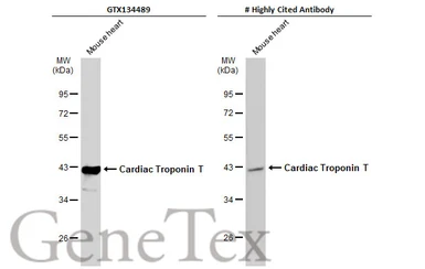 Anti-Cardiac Troponin T antibody used in Western Blot (WB). GTX134489