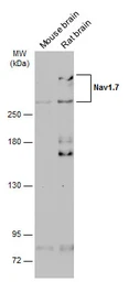 Anti-Nav1.7 antibody used in Western Blot (WB). GTX134494