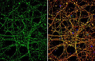 Anti-Nav1.7 antibody used in Immunocytochemistry/ Immunofluorescence (ICC/IF). GTX134494