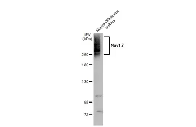 Anti-Nav1.7 antibody used in Western Blot (WB). GTX134494