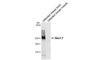 Anti-Nav1.7 antibody used in Western Blot (WB). GTX134494