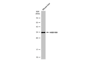 Anti-HSD11B1 antibody used in Western Blot (WB). GTX134509